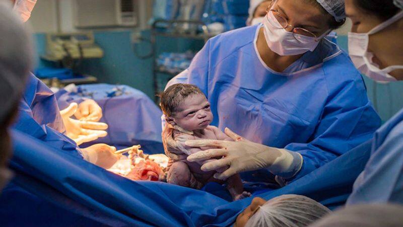 Photo of Brazilian baby born with Angry Face goes ciral on  Social media