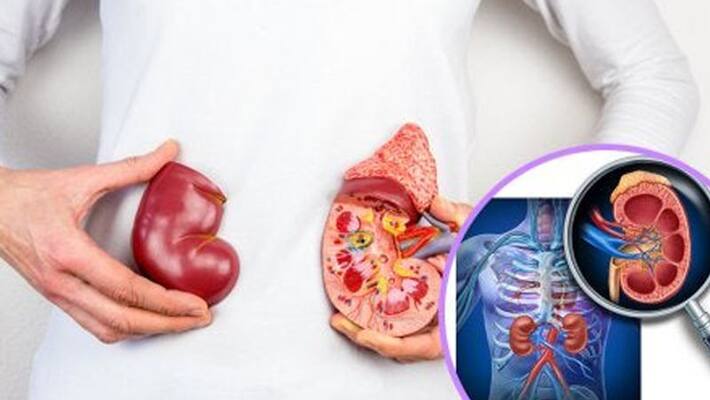 What can you do to keep your kidneys healthy What can you do to keep your kidneys healthy