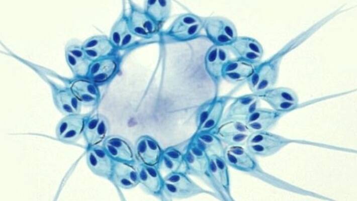 Scientists discover a new life can live without oxygen Scientists discover a new life can live without oxygen