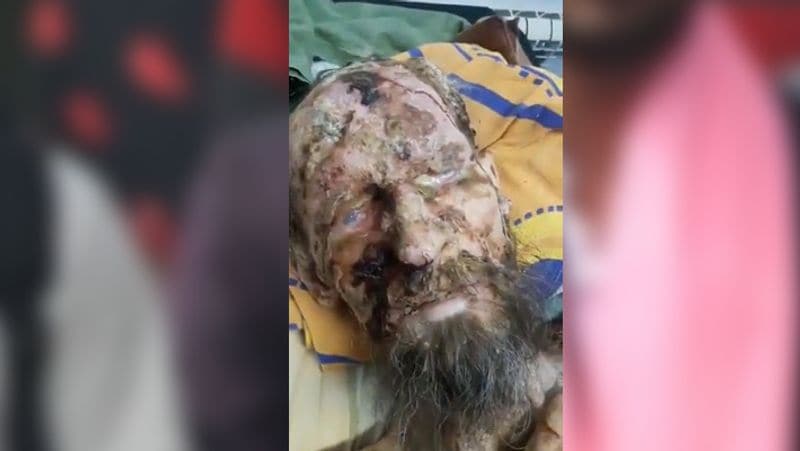 सोशल मीडिया पर वायरल हो रहे इस वीडियो में एक व्यक्ति नजर आ रहा है। उसके शरीर पर कई घाव भी साफ दिख रहे हैं।