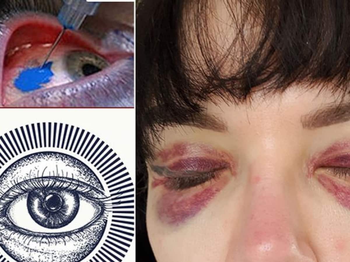 Woman inspired to tattoo her eyes like model Amber Luke goes blind   newscomau  Australias leading news site