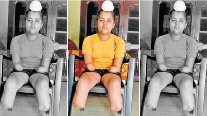 Story related to the emotion and encouragement of a child who lost both his legs in an accident kpa Story related to the emotion and encouragement of a child who lost both his legs in an accident kpa
