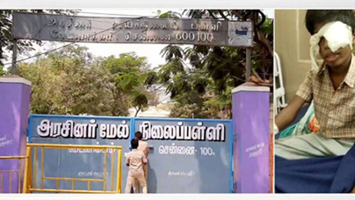government school teacher Iron Scale beat...student Lost eye sight government school teacher Iron Scale beat...student Lost eye sight