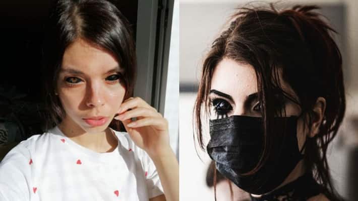 After getting a black eyeballs tattooed Poland model loses eyesight After getting a black eyeballs tattooed Poland model loses eyesight