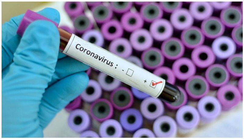 The coronavirus panic was to deflect the CAA struggle