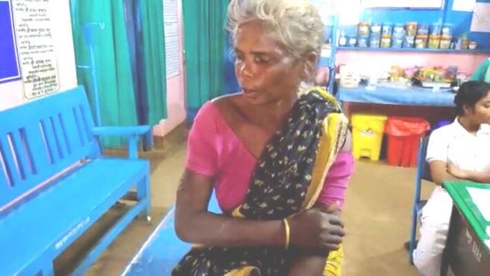 People slaps woman on witch allegation in Jhargram People slaps woman on witch allegation in Jhargram