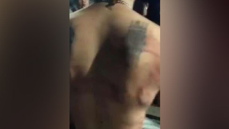 german man cuts off his genitals and throw it away