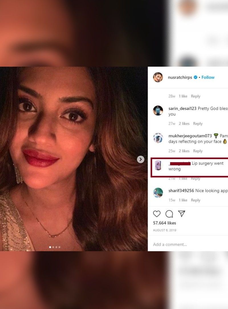 আসা যাক নুসরত জাহানের কথায়। তাঁকে নিত্যদিনেই ধর্ম নিয়ে, বিয়ে নিয়ে নানা ট্রোল করে যায় নিন্দুকরা। তবে সার্জারি বিষয় কেবল নিন্দুকরা নয়, বলেছে ভক্তরাও। তাদের মনে হয়েছে, নুসরতের ঠোঁটের মধ্যে ব্যাপক পার্থক্য দেখা দিয়েছে। তাঁর ঠোঁট আগের থেকে অনেক বেশি মোটা হয়ে গিয়েছে।