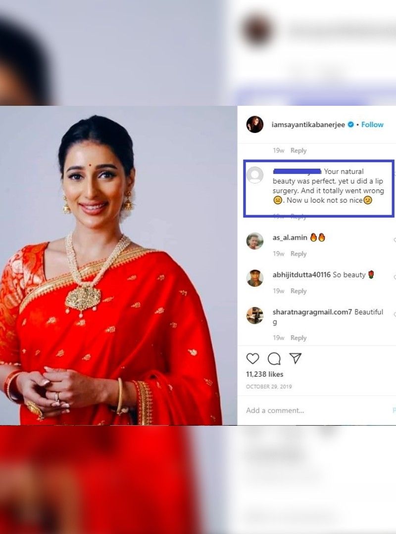 তাঁর সার্জারি নাকি একেবারেই খারাপ রূপে প্রকাশ পেয়েছে। তার প্রমাণ হল নায়িকার ক্লোজ আপ শট। বেশ কয়েকটি সেলফিতে তাঁর ঠোঁটের আকার দেখতে অদ্ভুত লাগছে। সেই কারণেই কি নেটিজেন এই সার্জারি দাবি করে চলেছে।