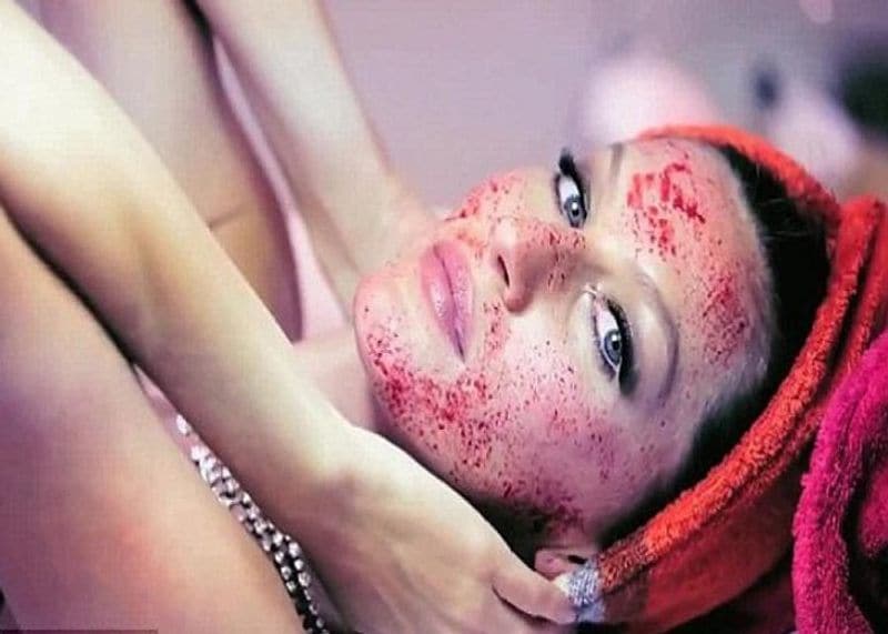 what is vampire facial cost and full procedure blood facial technique kpt
