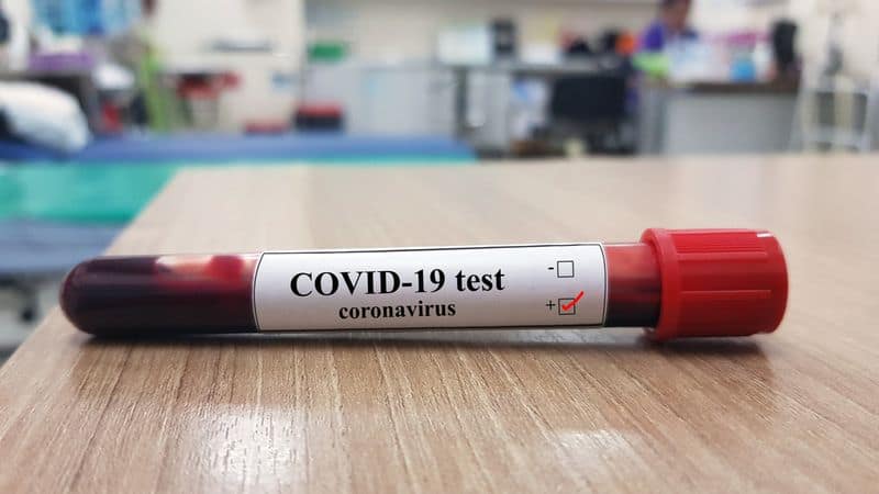 is india not testing COVID 19 enough, the reason behind low number of confirmations?