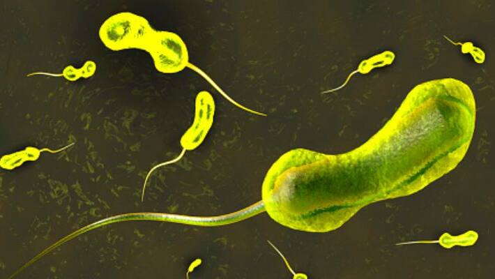 Presence of cholera-causing bacteria detected in Kozhikode Presence of cholera-causing bacteria detected in Kozhikode