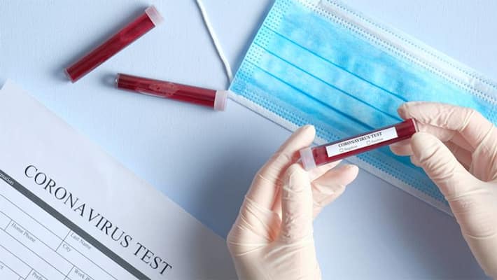ICMR revises COVID-19 testing strategy, here's how India will test patients now ICMR revises COVID-19 testing strategy, here's how India will test patients now
