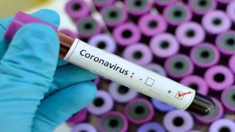 nobel winner michael levitt predicts world will get back soon from corona virus threat