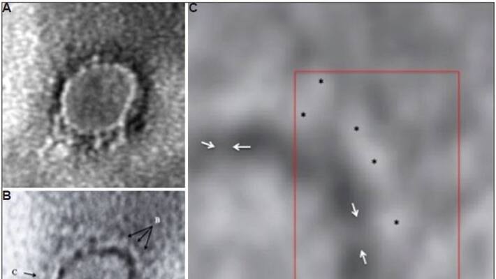 This is how the corona virus looks ... This is how the corona virus looks ...