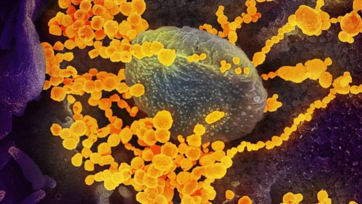 Why did the virus get the name Corona, how does it spread and can its infection occur again? MJA Why did the virus get the name Corona, how does it spread and can its infection occur again? MJA