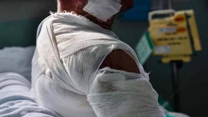 wife set fire on husband with her lover in motihari pra wife set fire on husband with her lover in motihari pra