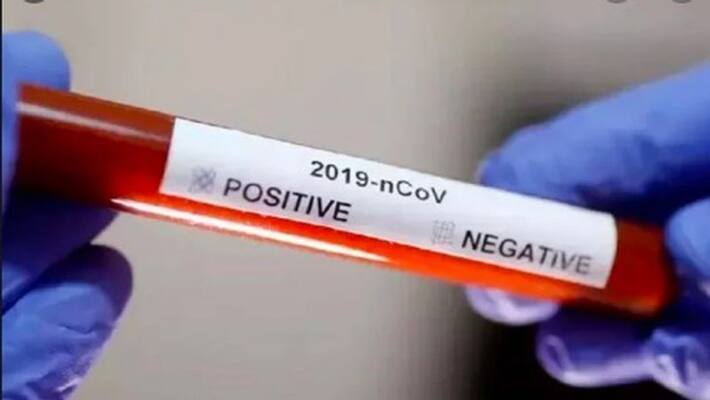 one more positive case at coronavirus in basti kpl one more positive case at coronavirus in basti kpl
