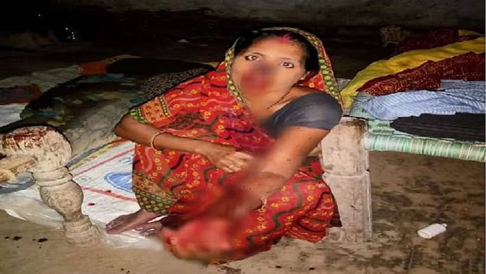 Husband beats wife's nose after controversy, a small thing becomes painful punishment asa Husband beats wife's nose after controversy, a small thing becomes painful punishment asa
