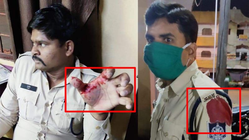 हमले में दो सिपाही घायल हो गए। एक के बाएं हाथ और दूसरे सिपाही के बाएं कंधे पर चाकू लगा है। घटना पुराने शहर के तलैया थाना स्थित इतवारा इलाके में हुई।