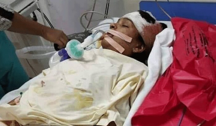 जानकारी के मुताबिक, 2 दिन से वंदना कोमा में थी। लेकिन, मंगलवार उसने दम तोड़ दिया। हालांकि हकीकत क्या थी, इसकी जांच होने के बाद ही सच्चाई सामने आ पाएगी। क्या वंदना तिवारी कोरोना के मरीजों की देखरेख कर रही थी या फिर कॉलेज डीन डॉ. इला गुजारिया के बताए अनुसार वो गर्ल्स हॉस्टल में केयर टेकर का काम करती थी।