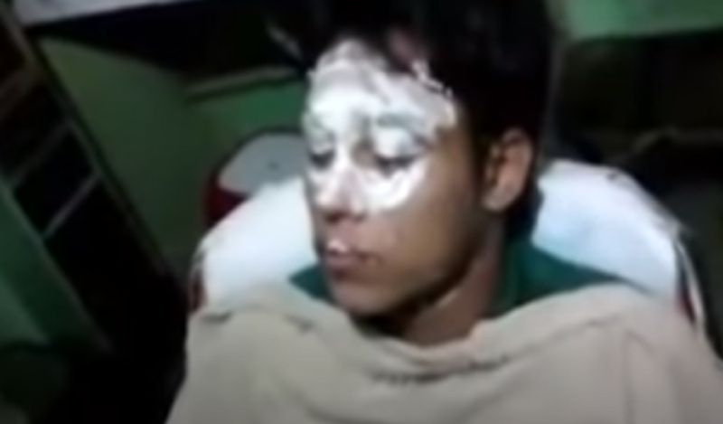शख्स ने कस्टमर के चेहरे पर पहले क्रीम लगाई। फिर उसकी आंखें बंद कर उसका मसाज करने लगा। लेकिन इस दौरान उसने एक घिनौना काम किया।