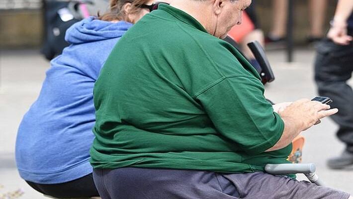 French expert claims, obese people more prone to infection with coranavirus MJA French expert claims, obese people more prone to infection with coranavirus MJA
