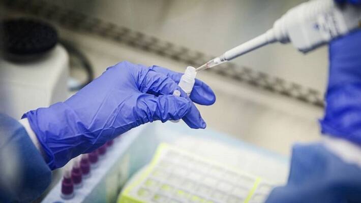 nurse tested covid 19 positive in uttarpradesh nurse tested covid 19 positive in uttarpradesh