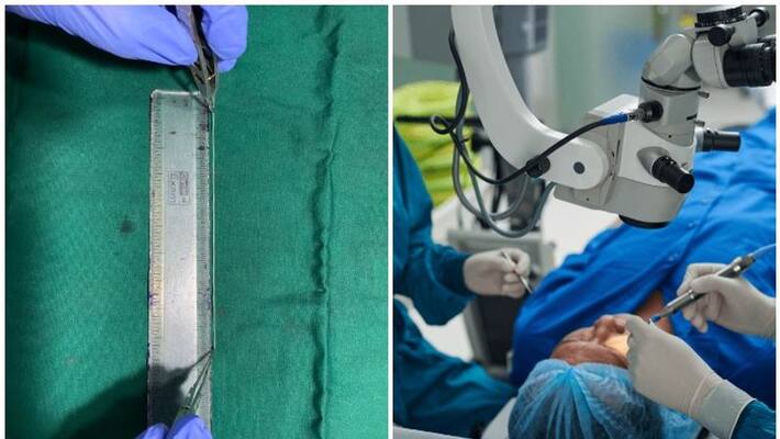 live worm found in surgery from eye of home maker in kayamkulam live worm found in surgery from eye of home maker in kayamkulam