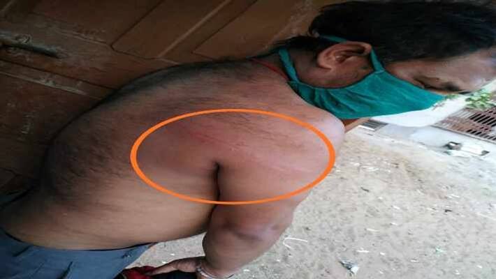 police beats a doctor in munger who engaged in battle of covid19 pra police beats a doctor in munger who engaged in battle of covid19 pra