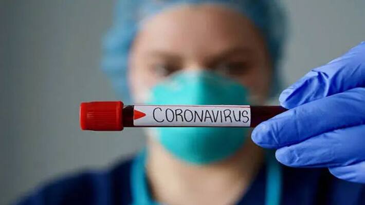 34 had no coronavirus infection 34 had no coronavirus infection