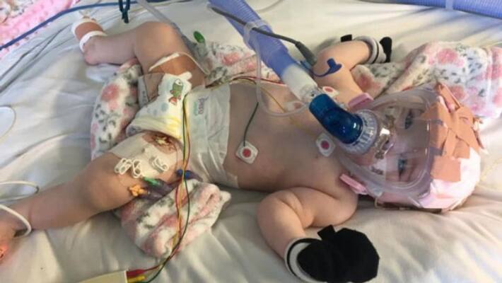 baby who survived heart surgery now battling covid baby who survived heart surgery now battling covid