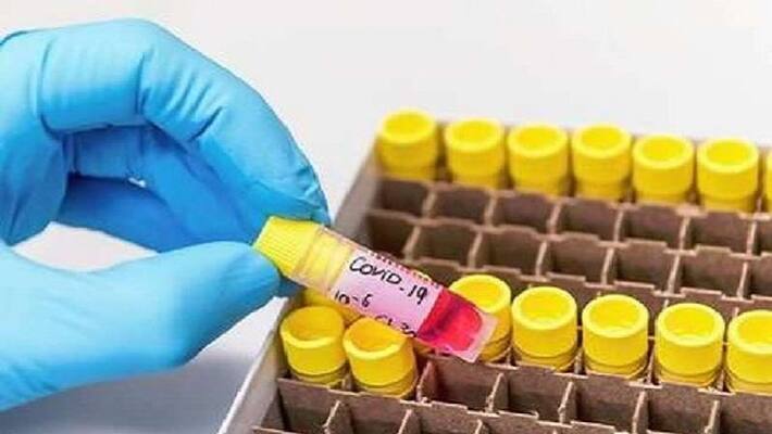 11 deaths due to corona in UP so far, number of infected patients reached 665 asa 11 deaths due to corona in UP so far, number of infected patients reached 665 asa