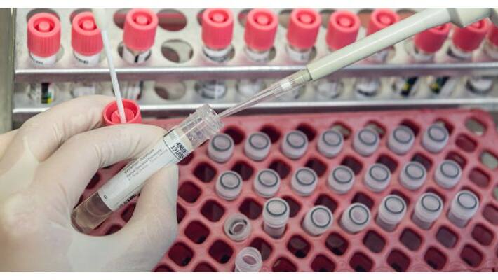 world health organization clarifies that there is no evidence for antibody tests can show coronavirus immunity world health organization clarifies that there is no evidence for antibody tests can show coronavirus immunity