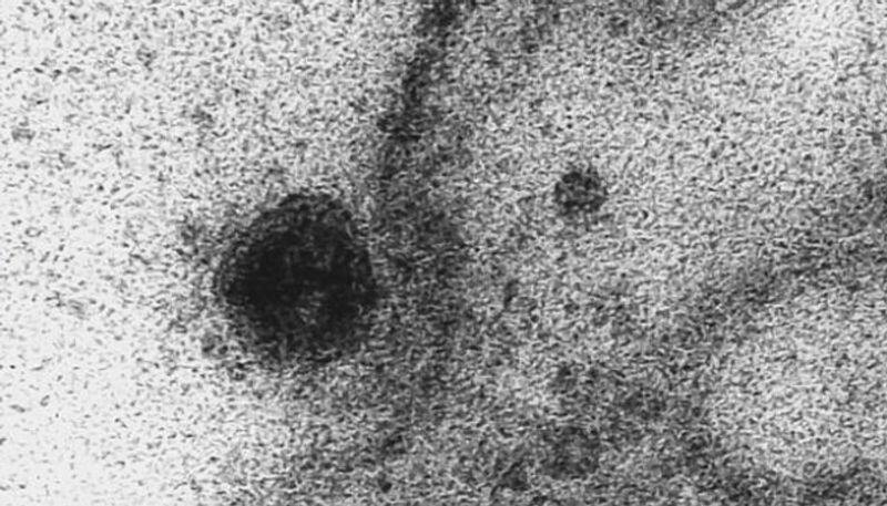 Exact moment coronavirus infects a healthy cell captured under microscope