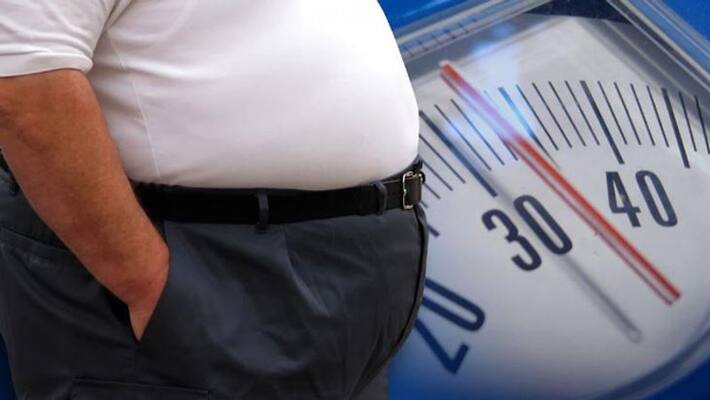 Obesity a major risk factor for COVID-19, doctor says Obesity a major risk factor for COVID-19, doctor says