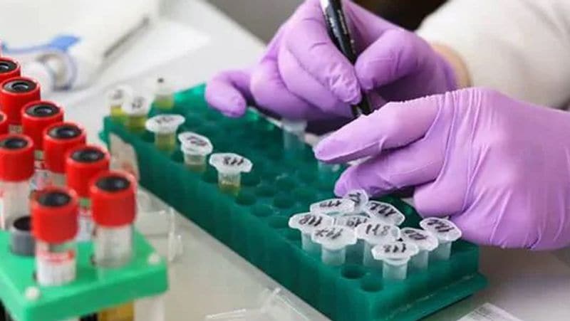 वुहान से लेकर इंग्लैंड, अमेरिका से लेकर ऑस्ट्रलिया तक के लैब वैक्सीन बनाने के लिए काम कर रहे हैं। इससे पहले ईबोला की वैक्सीन पांच साल के रिसर्च के बाद बनी थी। इस बार पूरी दुनिया आपात स्थिति से निपट रही है, इसलिए तैयारी उसी तरह से हो रही है।
