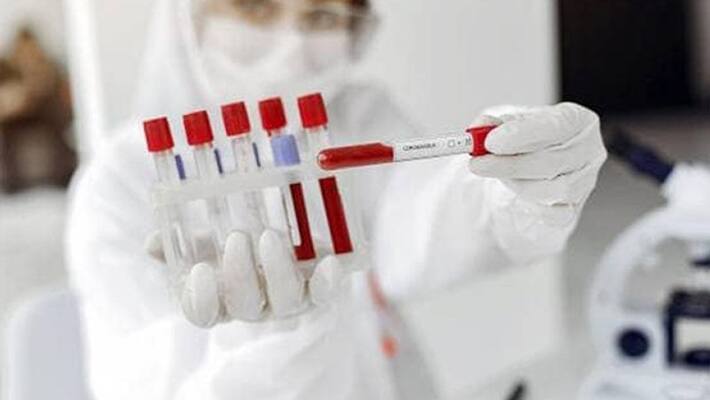 Two journalists test COVID-19 positive in Tamil Nadu Two journalists test COVID-19 positive in Tamil Nadu