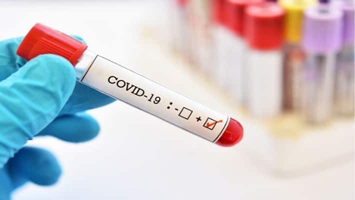 rapid test kit from China prohibits investigation in up kpl rapid test kit from China prohibits investigation in up kpl