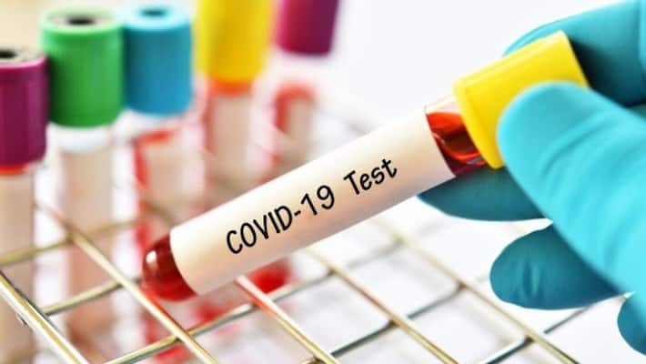 doctor clarifies doubts about covid 19 test doctor clarifies doubts about covid 19 test