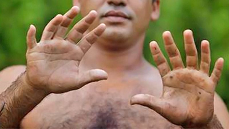 ನಿಮ್ಮ ಅಂಗೈಯಲ್ಲಿ ಒಂದು ಚಲನೆ ಇದ್ದರೆ, ಶೀಘ್ರದಲ್ಲೇ ತೊಂದರೆ ಅನುಭವಿಸುವಿರಿ ಎಂದರ್ಥ.