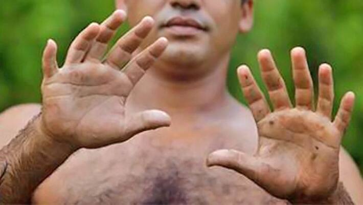 people with more then 10 fingers in hand are lucky KPI people with more then 10 fingers in hand are lucky KPI
