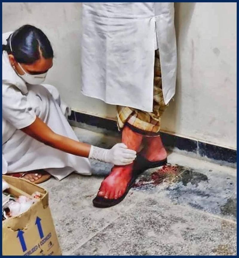 ये निकला नतीजा-
सोशल मीडिया पर इस तस्वीर से जुड़े दावे ग़लत हैं जिनपर भरोसा नहीं करना चाहिए। तस्वीर में नर्स पैर धो नहीं रही बल्कि खून बहने से रोकने की कोशिश कर रही हैं।
