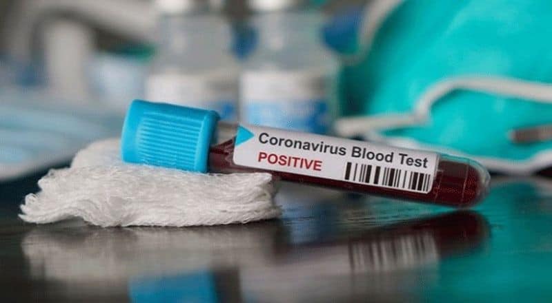 krishnagiri Govt doctor coronavirus affected