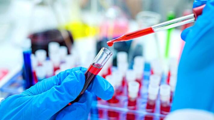 COVID19 positive patient in maharastra dies after plasma therapy fails COVID19 positive patient in maharastra dies after plasma therapy fails