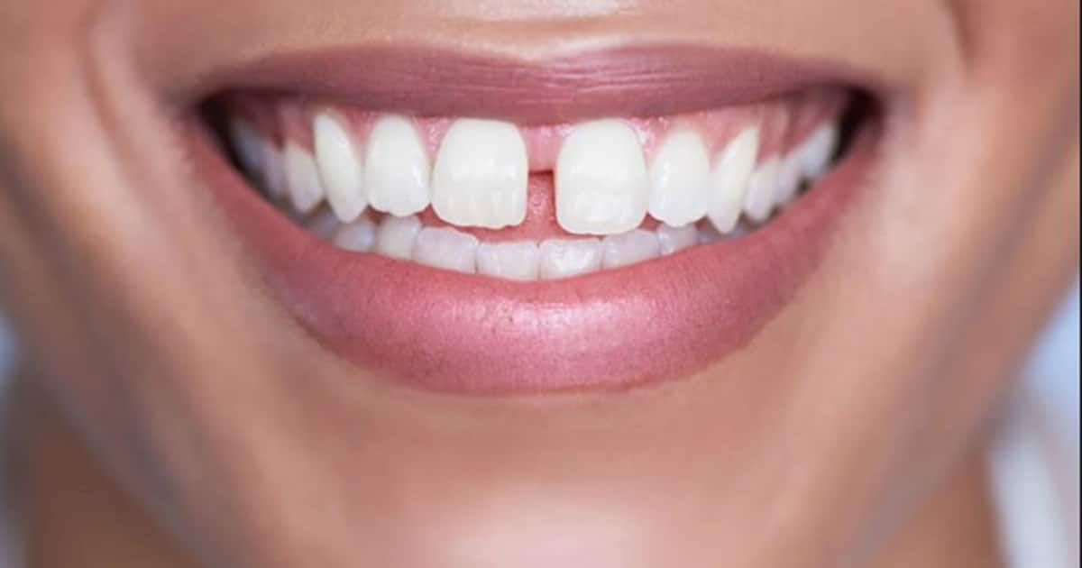 यह है 100 सालों तक दांतों को स्वस्थ रखने का असली घरेलू नुस्खा