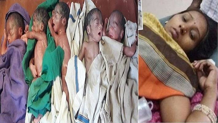 Woman gave birth to 5 children, 2 of them are boys and 3 girls, Normal Delivery asa Woman gave birth to 5 children, 2 of them are boys and 3 girls, Normal Delivery asa