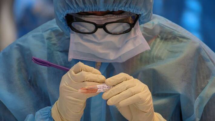 Coronavirus risk for three-quarters of the world .. Stunning research results Coronavirus risk for three-quarters of the world .. Stunning research results