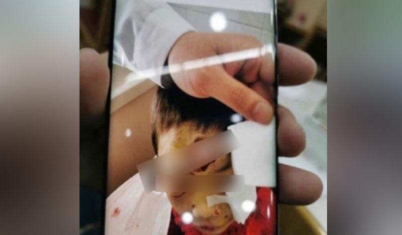 heartless stepmother abuses 4 year old daughter during lockdown cuts lips with scissors for calling her mummy kph