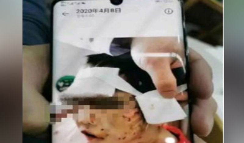 heartless stepmother abuses 4 year old daughter during lockdown cuts lips with scissors for calling her mummy kph